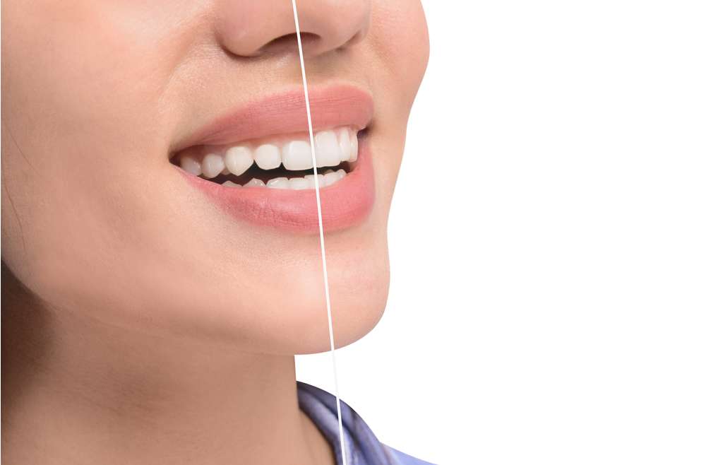 Was ist Zahnfleischästhetik?