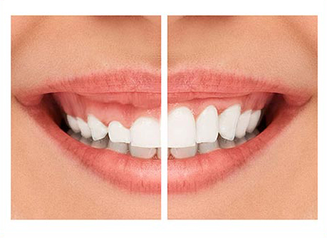 طب الأسنان التجميلي